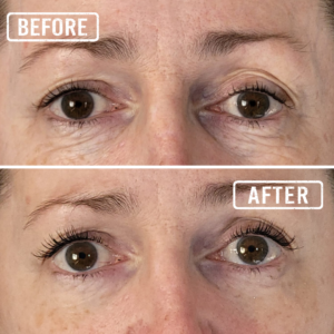 NuEyes - Rejuvenating Eye Cream - Image 3