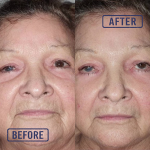 NuRejuv Beauty Bundle - Image 5