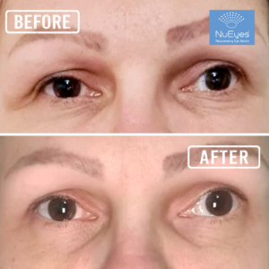 NuRejuv Beauty Bundle - Image 4